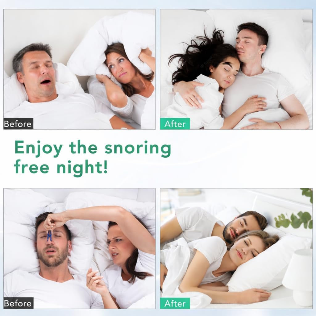 Duna Nasal Dilator Kit